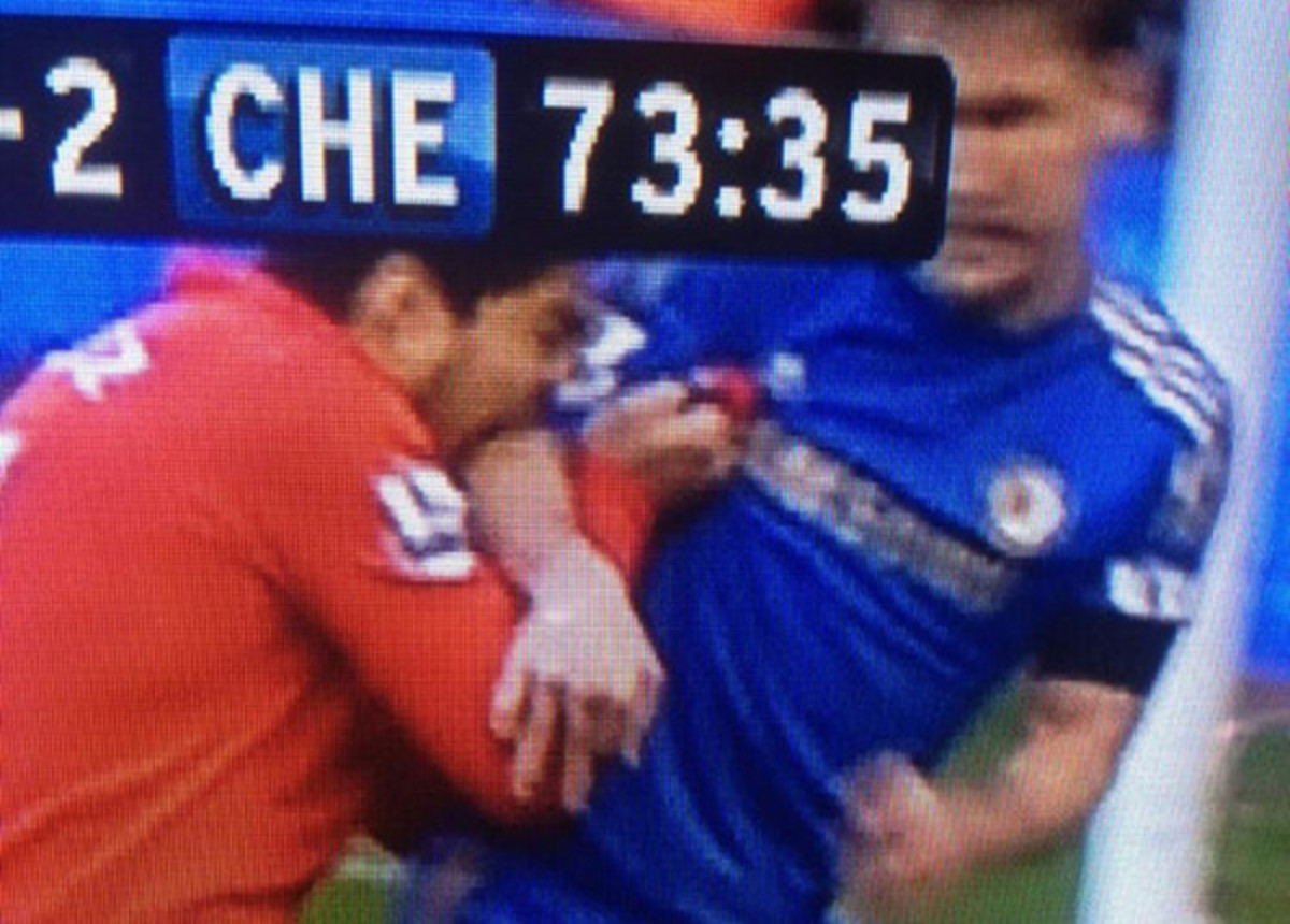 suarez-bite-t1